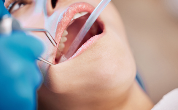 Benefits Of A Tooth Extraction